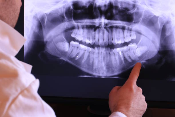 Best Emergency Dentist for Knocked-Out Tooth in Congress, AZ